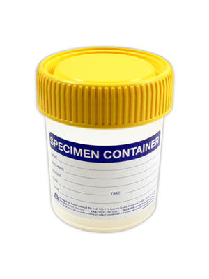 Specimen Container 70ml 